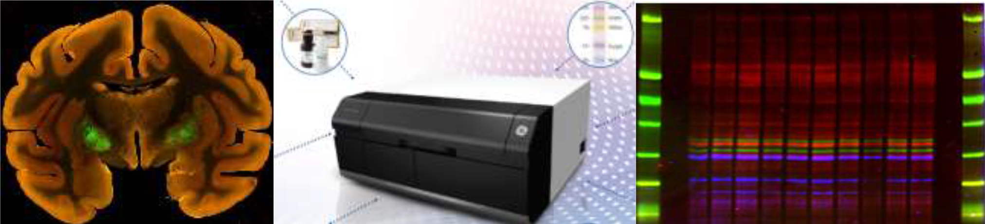 Webinaire Scanner Amersham™ Typhoon™ 5