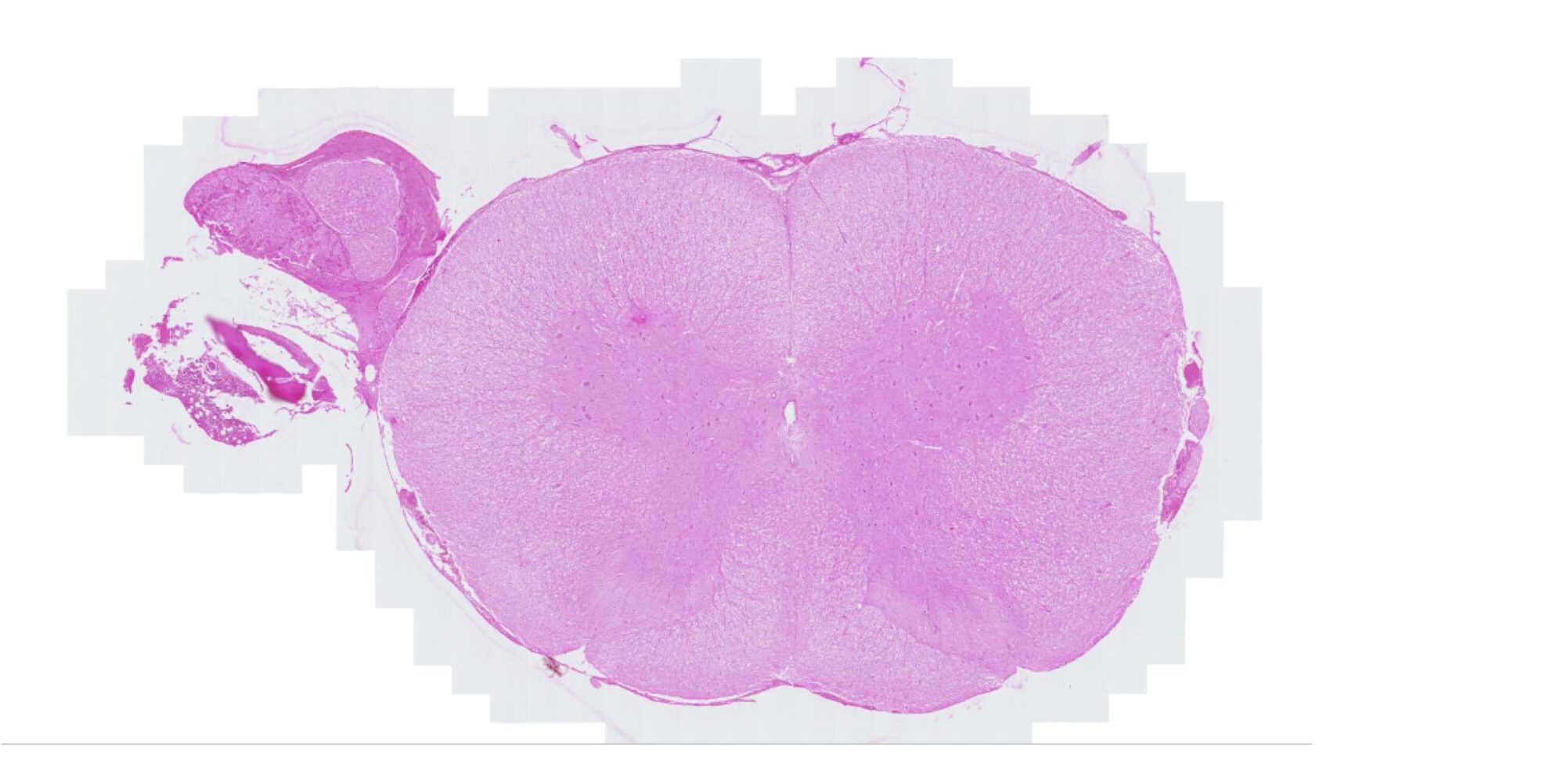 Les lames virtuelles